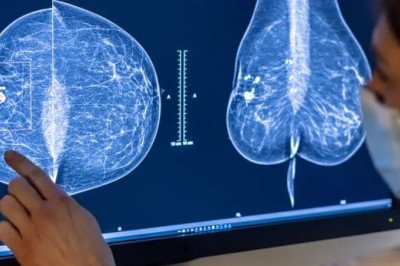 Google dhe Med Tech Company bashkë për të zhvilluar mjete të kontrollit të tumorit