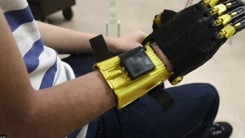 Studentët e Shkollës së Mesme të Tennessee ndërtojnë dorë robotike për shokun e klasës