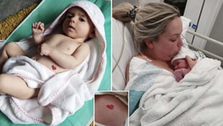 Histori e rrallë/ Foshnja e lindur në shkurt, njihet si vajza e vogël me zemrën e përsosur të dashurisë