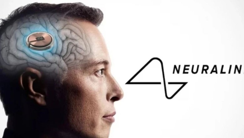 Mijëra njerëz të gatshëm të implantojnë çipin Neuralink të Elon Musk në trurin e tyre!