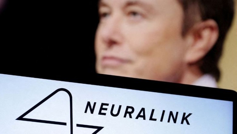 Elon Musk: Pacienti i parë me çip në tru është rikuperuar plotësisht mund të trajtojë obezitetin, autizmin, depresionin dhe skizofreninë!