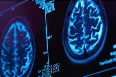 Ky është aplikacioni që mund t’ju ndihmojë në zbulimin e shkakut të demencës